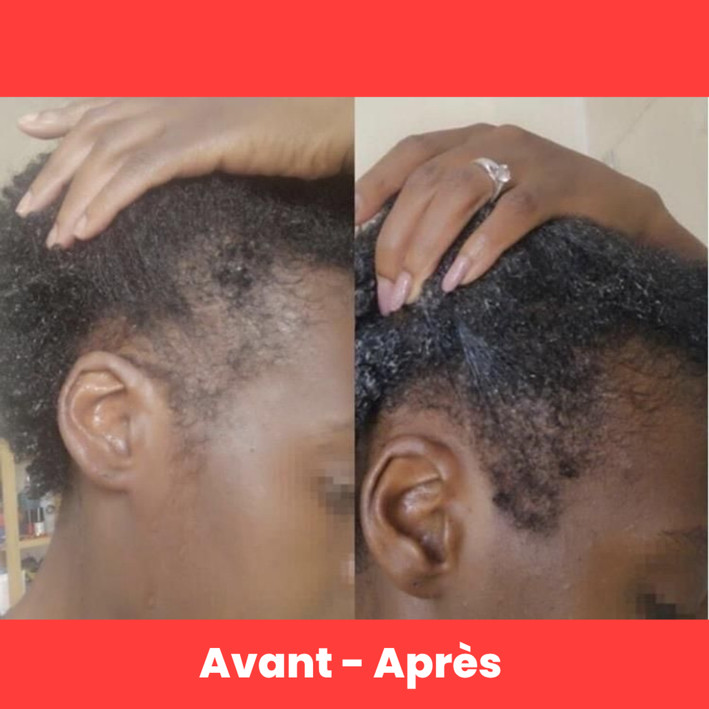 Elixir capillaire - Anti-Chute & Pousse