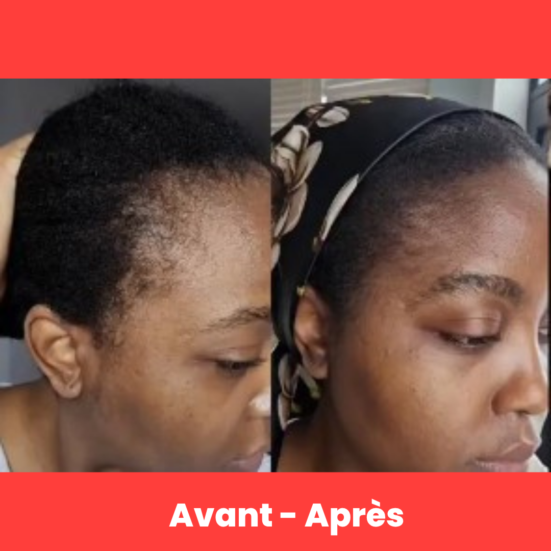 Elixir capillaire - Anti-Chute & Pousse